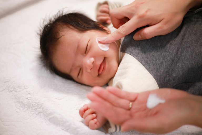 嬰兒臉上紅疹擦什麼才會好？