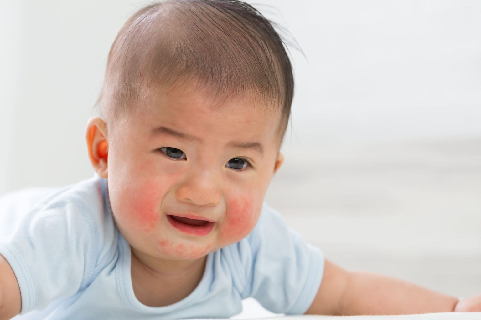 新生兒皮膚脫皮怎麼辦？寶寶4種常見皮膚狀況，清潔與保養可以這樣做