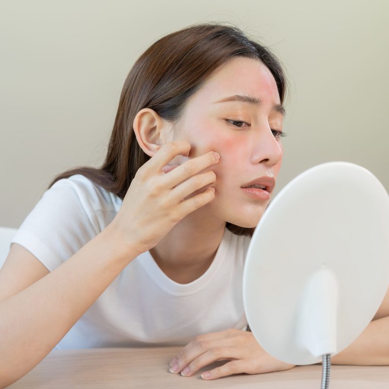 皮膚泛紅怎麼辦？緩解寶寶、大人肌膚泛紅的日常方法分享